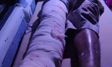 हैवी ब्लास्टिंग के चलते हुआ हादसा