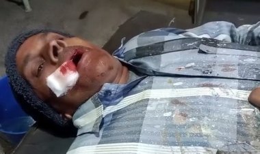 एक दर्जन से ज्यादा लोग हुए घायल 