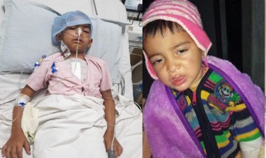 चिरंजीवी योजना में हृदय रोग से ग्रसित बालकों की हुई निःशुल्क सर्जरी