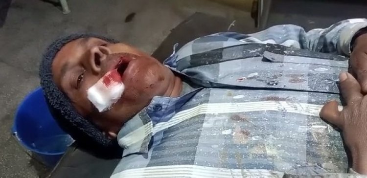 एक दर्जन से ज्यादा लोग हुए घायल