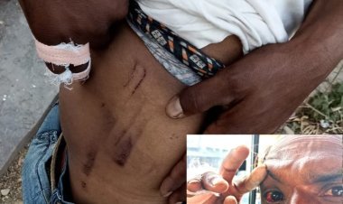 कांस्या पुलिस चौकी के पुलिसकर्मियों पर घर में घुस कर मारपीट करने का आरोप