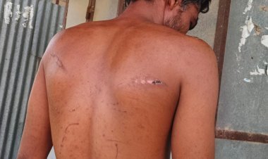 मारपीट कर कंटीली बाड़ में फेंक देने का आरोप