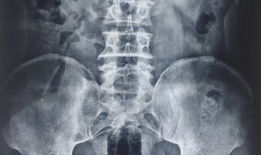  कुछ युवकों ने एक युवक की बर्बर तरह से की पिटाई,  युवक के गुप्तांग में डाली प्लास्टिक की केन,  युवक की स्थिति गंभीर