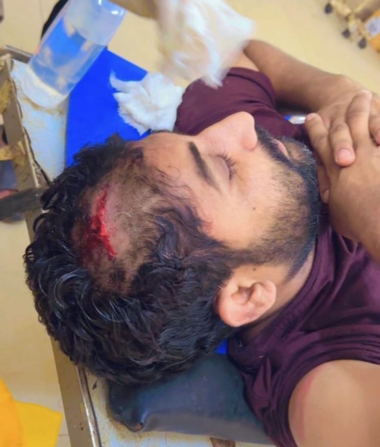 दुकानदार सहित दो लोगों पर एकराय होकर कुल्हाड़ी व सरियों से जानलेवा हमला करने व गल्ले से रूपये लूट कर ले जाने का आरोप, 11 लोगों के खिलाफ मामला दर्ज