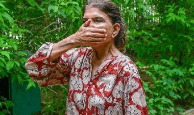 जयपुर के सेंट्रल पार्क में महिला से लूट, गला दबाकर की बेहोश; एक घंटे तक पार्क में पड़ी रही, कोई मदद को नहीं आया