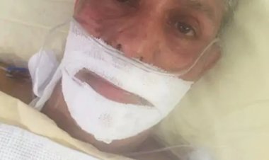 ब्रसेल्स ब्लास्ट की सर्वाइवर निधि चापेकर की दास्तां: 20 सर्जरी झेली, फिर भी टूटी नहीं… अब बनेगी फिल्म