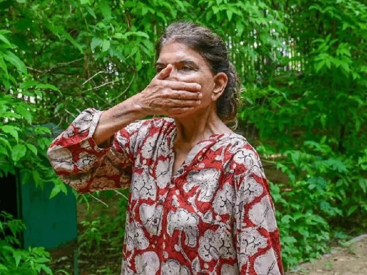 जयपुर के सेंट्रल पार्क में महिला से लूट, गला दबाकर की बेहोश; एक घंटे तक पार्क में पड़ी रही, कोई मदद को नहीं आया